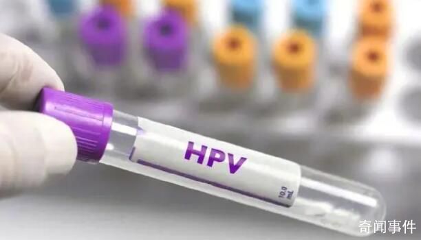 男童喉咙长菜花样肿块确诊感染HPV 小小年纪怎么会和HPV扯上关系