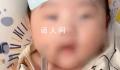 婴儿被亲友轮番亲吻高烧近40度 就医后孩子被诊断为病毒感染
