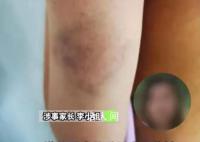 教师体罚学生被开除44名家长挽留 老师确实得到了同事和学校的认可