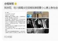 姑娘嗓子疼从就诊到去世仅10分钟 急性会厌炎是什么