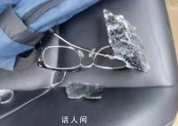 记者在贵州毕节采访遭殴打 当地回应 