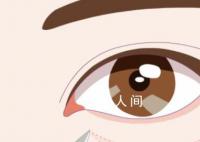 女子3千割眼袋3个月眼睛闭不合 割眼袋有哪些风险