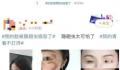 隐翅虫的毒液堪比硫酸 隐翅虫是什么来头?