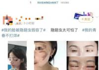 隐翅虫的毒液堪比硫酸 隐翅虫是什么来头?