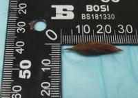 男子吃粽子误吞枣核致小肠穿孔 运气确实差了点