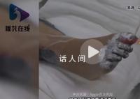 女孩充电被电击内脏受损面临截肢 这到底是怎么回事