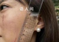 法院回应女子称被女法官抓伤面部 简直不可思议呀
