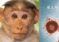 辽宁沈阳发现一例猴痘病例 有哪些易感人群