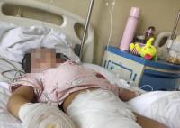 继母涉嫌虐待继女致其残疾 背后真相实在是令人发指