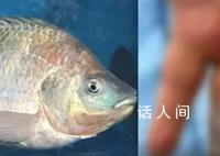 男子被鱼刺刺伤致手指坏死被切除 医生判断是感染性休克