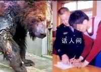 媒体评硫酸泼熊大学生任职中科院 引起社会热议