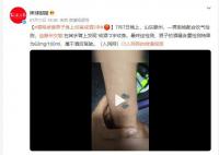 酒驾被查男子身上纹着戒酒2字