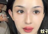 哈妮克孜被蚊子咬成香肠嘴 这一意外引起了广大网友的共鸣和关注
