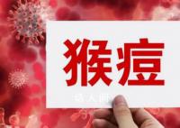 本轮猴痘疫情主要通过男男传播 如何预防猴痘感染