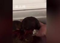 女子切野生菌时嗦手指致中毒 目前已恢复健康