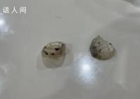 异物是鸭眼巩膜?记者解剖多个鸭头