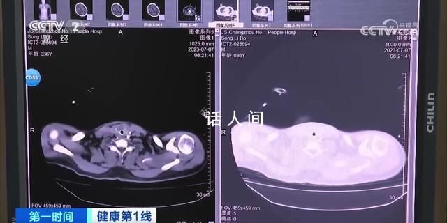 36岁男子吹空调住进ICU 如何预防空调病