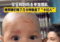 宝宝参加婚礼被亲一脸口红印 引起了广泛关注