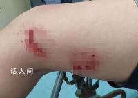 不明鱼类咬游客 有人掰开鱼嘴才摆脱
