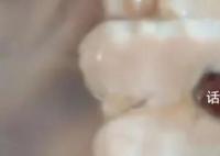 女子称买28元河蚌疑发现红色孔克珠 孔克珠有收藏价值吗