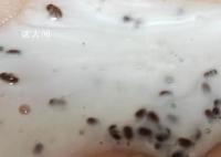 女生称海飞丝洗发水挤出大量虫卵 实在是太恶心了