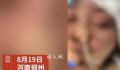 女子没给丈夫钱充手游被殴打失明 目前警方已经介入调查