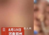 女子没给丈夫钱充手游被殴打失明 目前警方已经介入调查