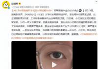女子长期侧躺玩手机致右眼短暂失明 两边眼睛的眼底都出现了豹纹状病变