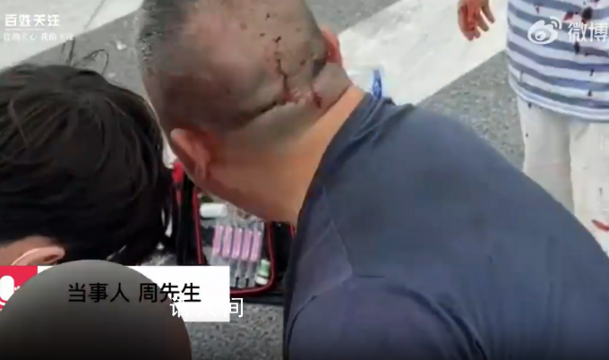 儿子被撞送医途中车祸致女儿身亡 认为赣州黄金机场对此事有不可推卸的责任