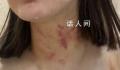 女子遭夫妻扒衣掐脖?警方介入