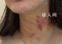 女子遭夫妻扒衣掐脖?警方介入