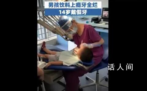 男孩喝饮料上瘾牙全烂14岁戴假牙 可乐雪碧却要连喝三瓶