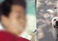 7岁娃被邻居家狗抓伤后离世 由于种种原因未能及时将孩子送往医院接受治疗