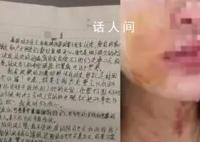 女子被夫妇殴打扒衣后吞安眠药自杀 送医后已抢救回来