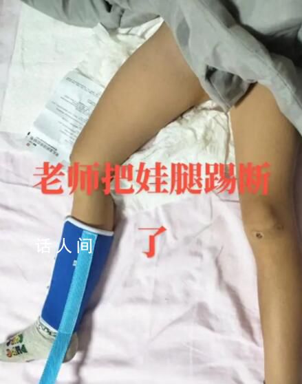 陕西一学生被老师踢断腿骨?官方回应
