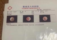 学生被老师掌掴耳膜穿孔?学校回应