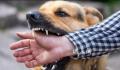 狂犬病潜伏期十几年?专家辟谣