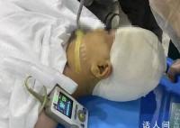 被老师打伤女孩头部水肿有感染风险 家属：希望对相关人员追责到底