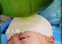 女孩被打破头骨同学大哭:老师杀人了