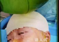 被打破头骨女生已清醒?家属回应