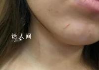 高铁拒换座被打女子:对方先动手
