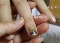 19岁女子被骗缅甸获救时遍体鳞伤 警方将进一步对该案涉及的缅北诈骗窝点深挖彻查