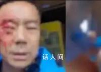 游客遭穿制服人员殴打 其妻发声