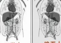 女子就医发现五脏六腑全长反 这种病例在全球的发生率仅为百万分之一
