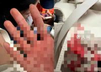 中国游客遇袭身亡:源计划凌晨回国