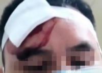 男子相亲被女方砍伤?警方辟谣
