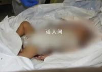 以色列公布婴儿遇害可怕照片 消息引发国际社会关注