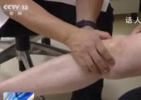长期跷二郎腿可能损伤关节 骨关节炎患者超1亿早诊早治是关键