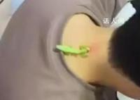 螳螂“大夫”为男子医治脖后瘊子 20分钟后螳螂将瘊子吃得干干净净
