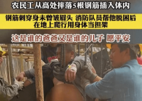 农民工高处坠落被5根钢筋扎穿 咬紧牙关配合消防和工友救援